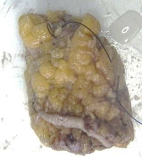 Description of the image